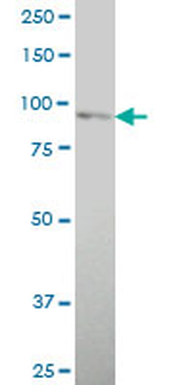 TLR2 Antibody in Western Blot (WB)