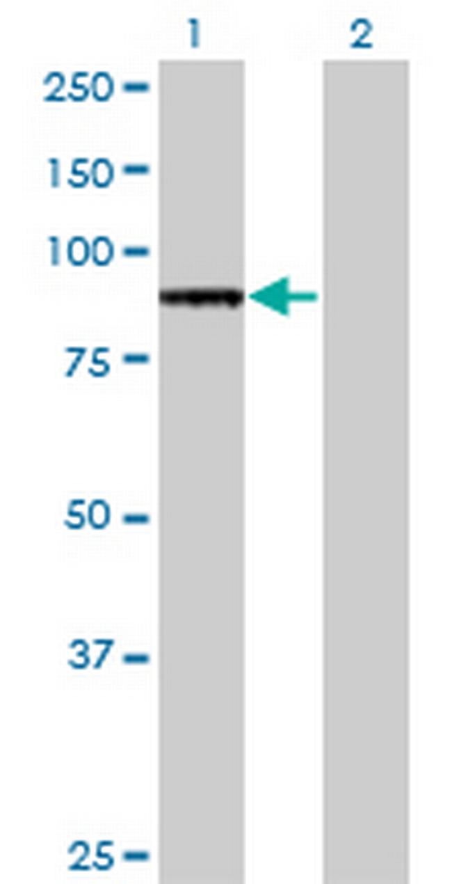 TLR2 Antibody in Western Blot (WB)