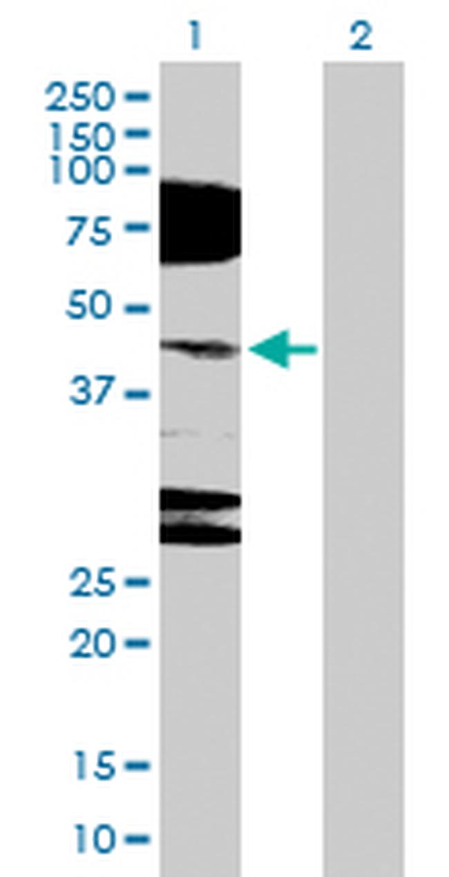 NR2E1 Antibody in Western Blot (WB)