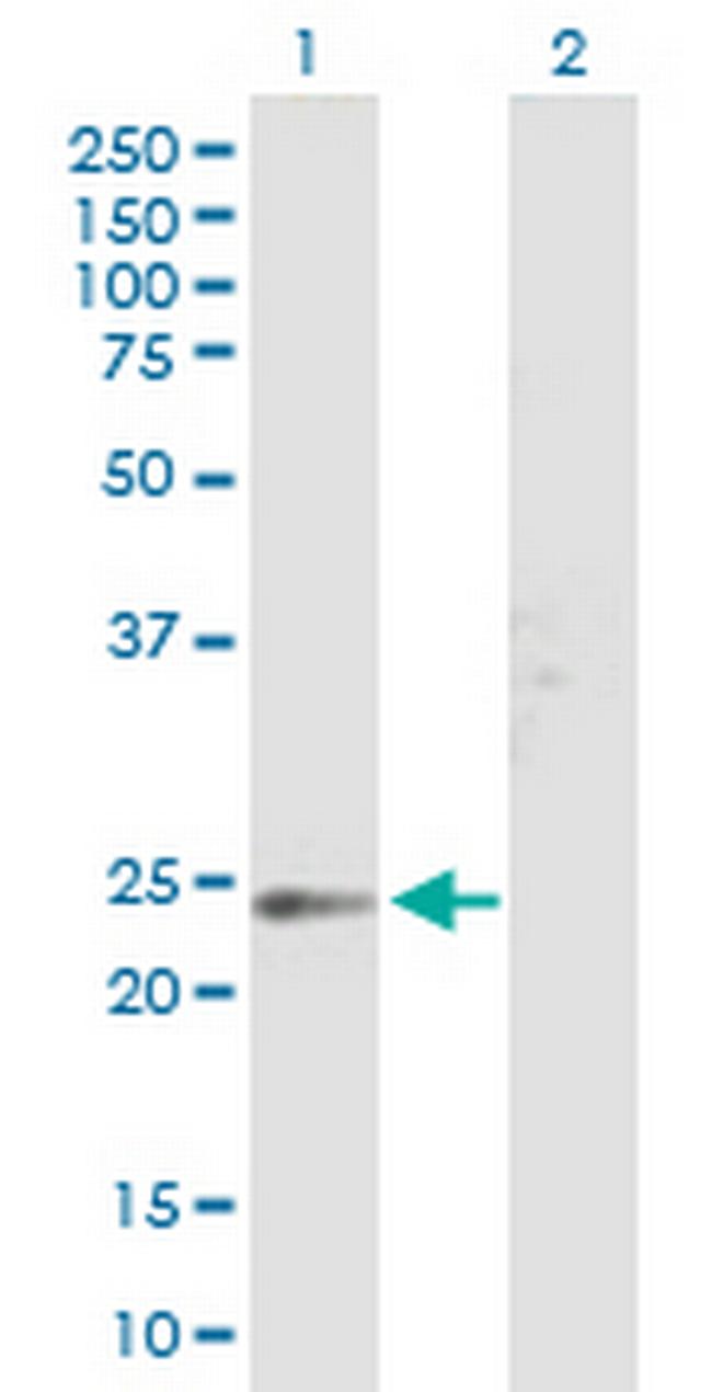 TSPAN8 Antibody in Western Blot (WB)