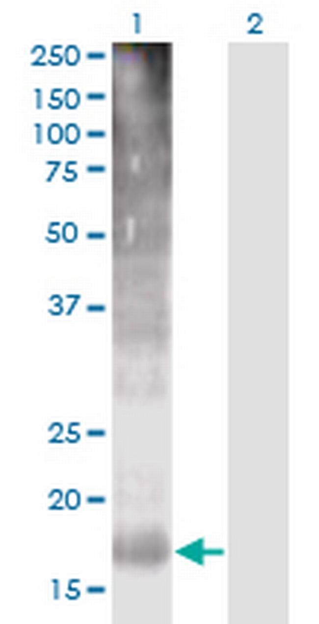 TM4SF4 Antibody in Western Blot (WB)