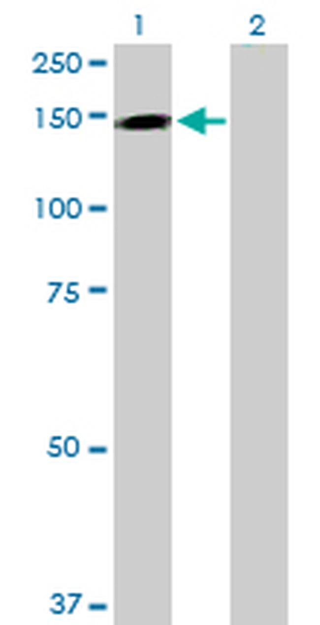TMEM1 Antibody in Western Blot (WB)
