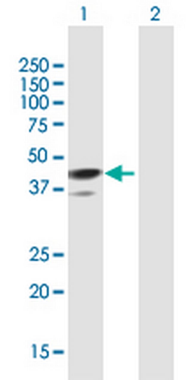 TMOD1 Antibody in Western Blot (WB)