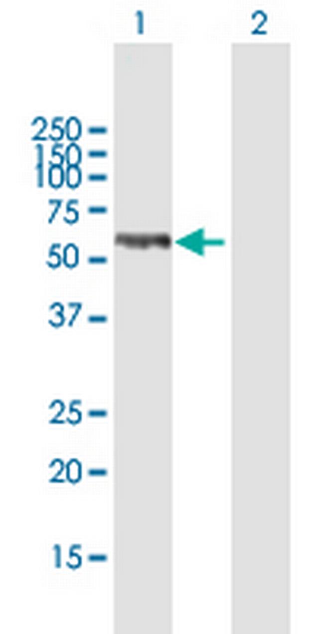 TMPO Antibody in Western Blot (WB)