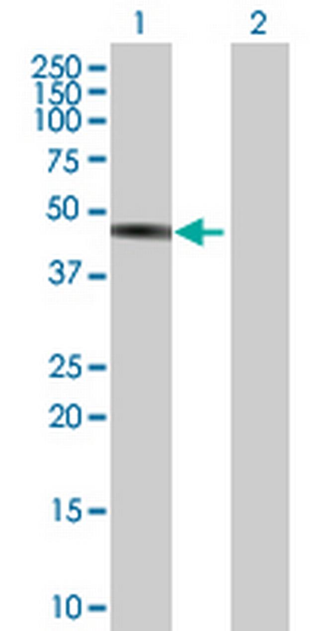 TNNT2 Antibody in Western Blot (WB)