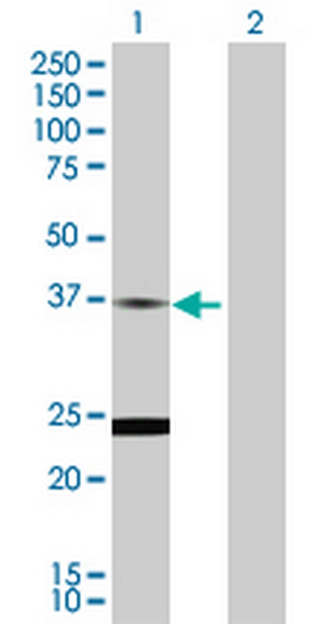 TNNT2 Antibody in Western Blot (WB)