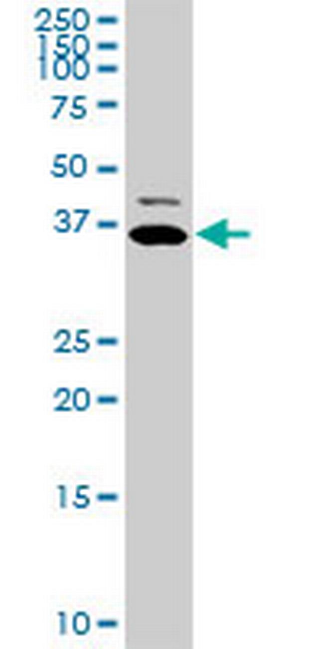 TNNT2 Antibody in Western Blot (WB)