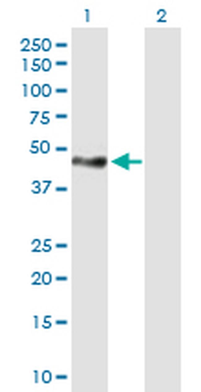 TNS1 Antibody in Western Blot (WB)