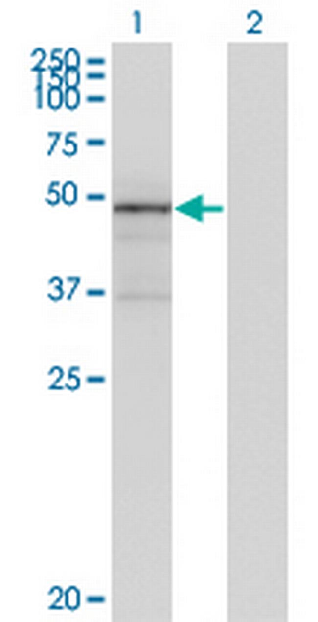 TNXB Antibody in Western Blot (WB)