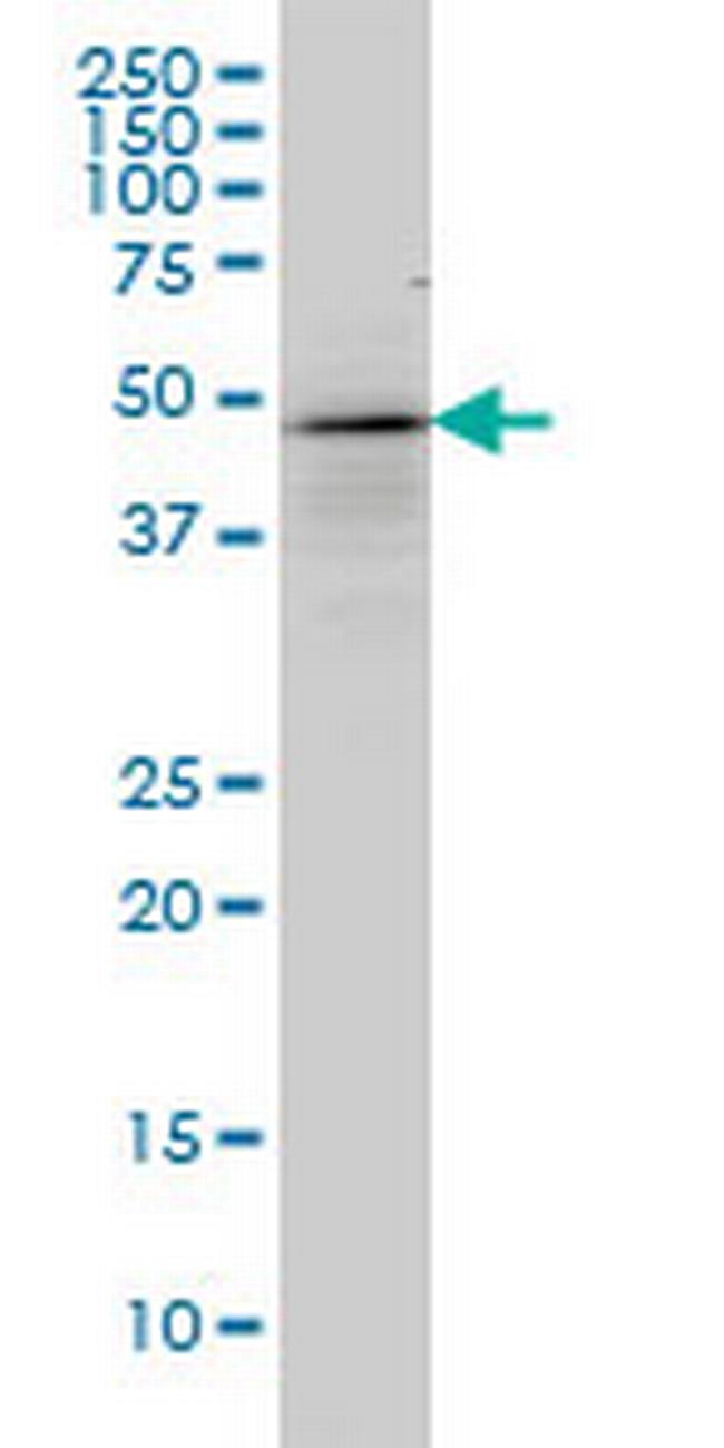 TP53 Antibody in Western Blot (WB)