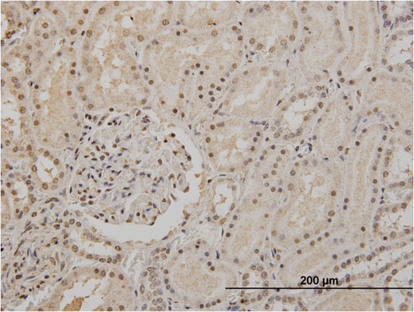 TP53 Antibody in Immunohistochemistry (Paraffin) (IHC (P))