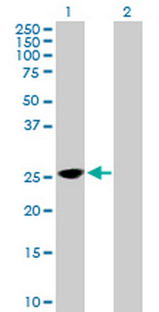 TPD52 Antibody in Western Blot (WB)