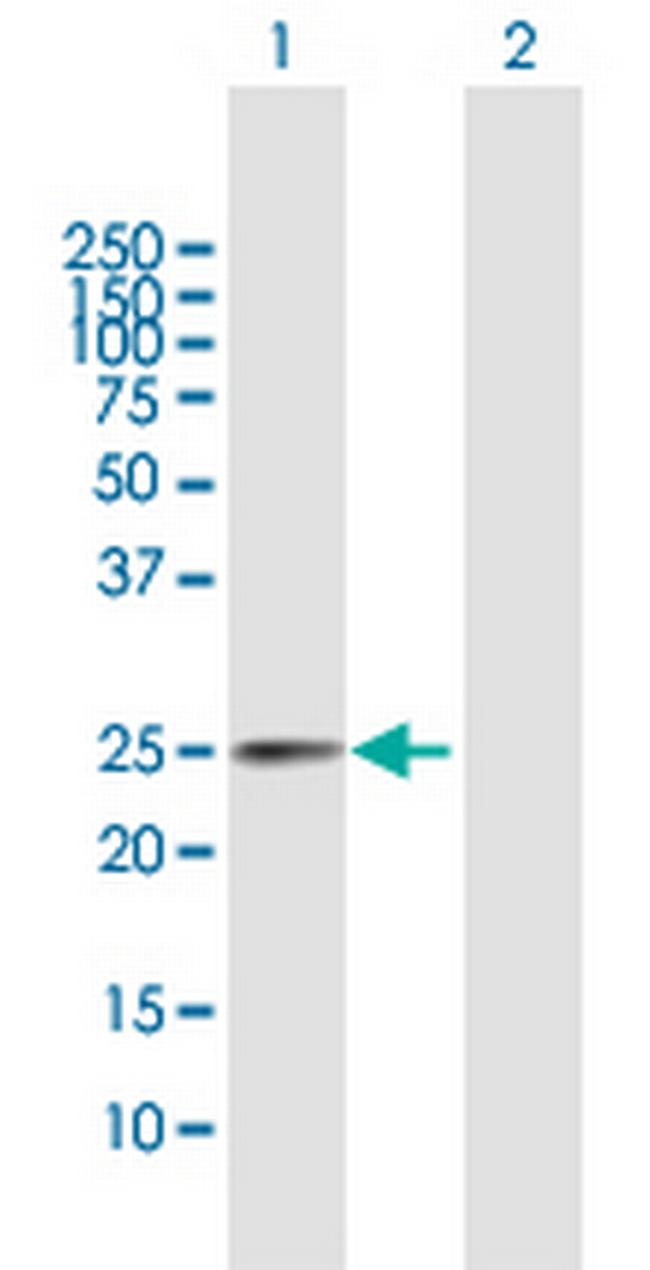TPD52 Antibody in Western Blot (WB)