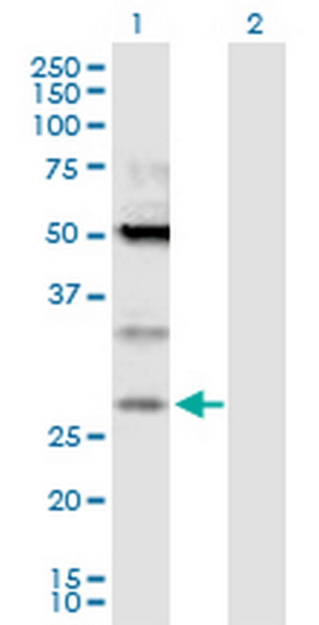 TPD52 Antibody in Western Blot (WB)