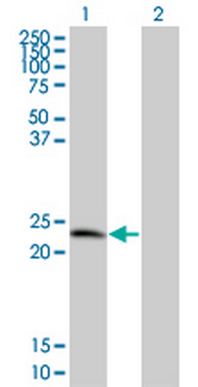 TPD52 Antibody in Western Blot (WB)