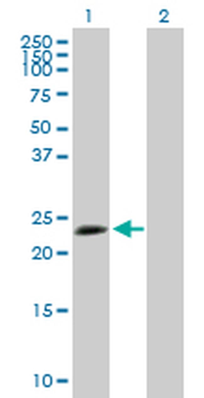 TPD52L1 Antibody in Western Blot (WB)