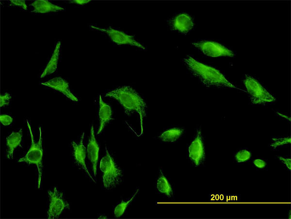 TPMT Antibody in Immunocytochemistry (ICC/IF)