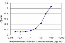 TPO Antibody in ELISA (ELISA)