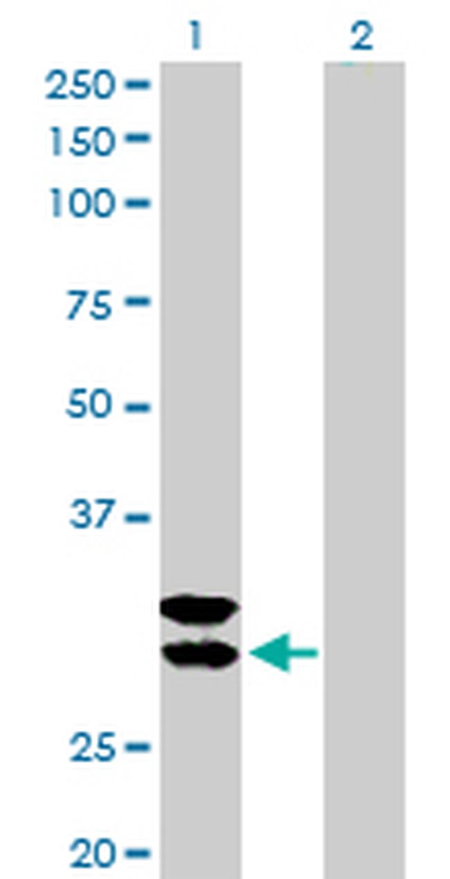 TPSAB1 Antibody in Western Blot (WB)