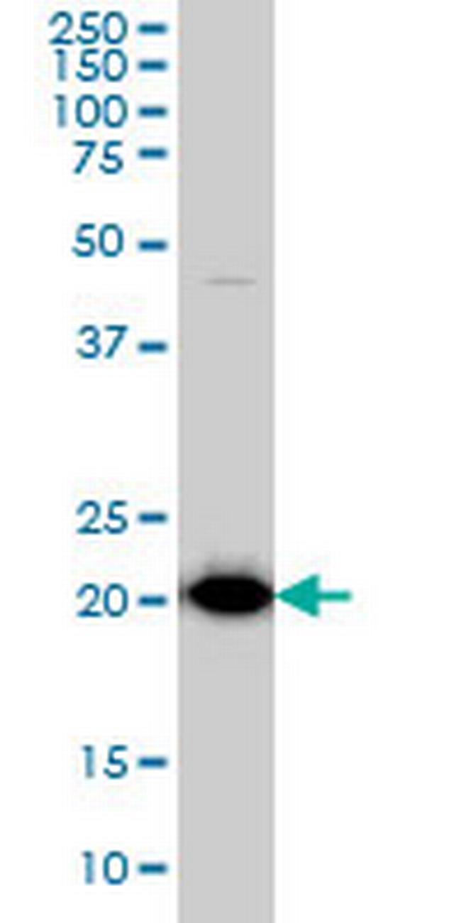 TPT1 Antibody in Western Blot (WB)