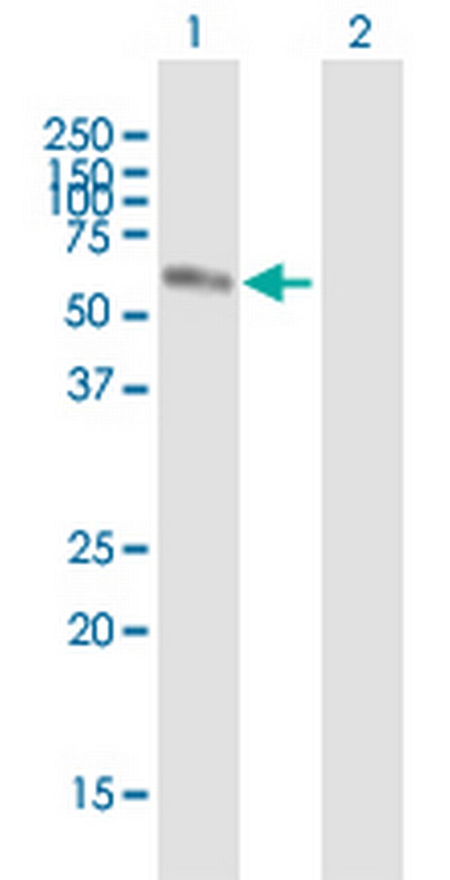 NR2C2 Antibody in Western Blot (WB)
