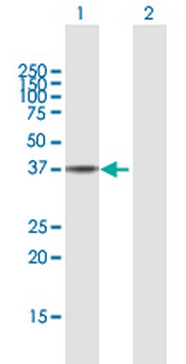 HSP90B1 Antibody in Western Blot (WB)