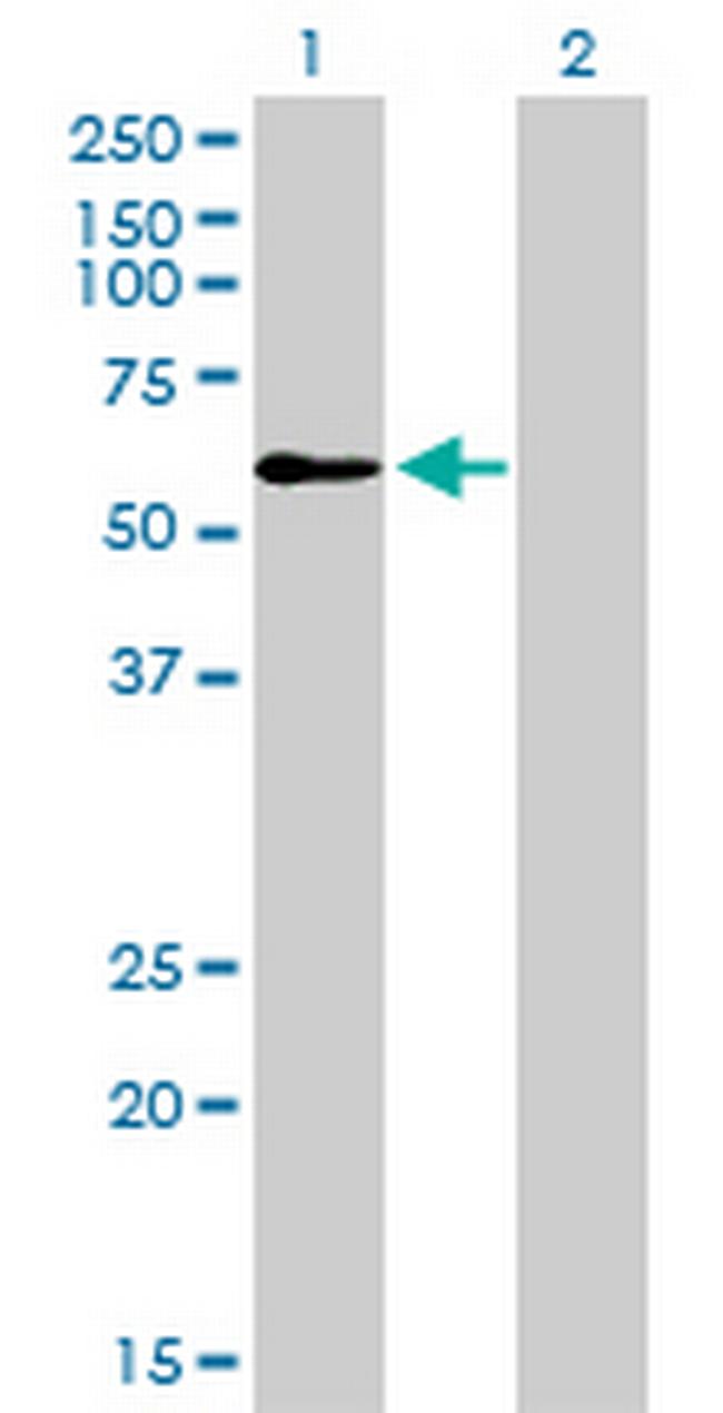 TRAF6 Antibody in Western Blot (WB)