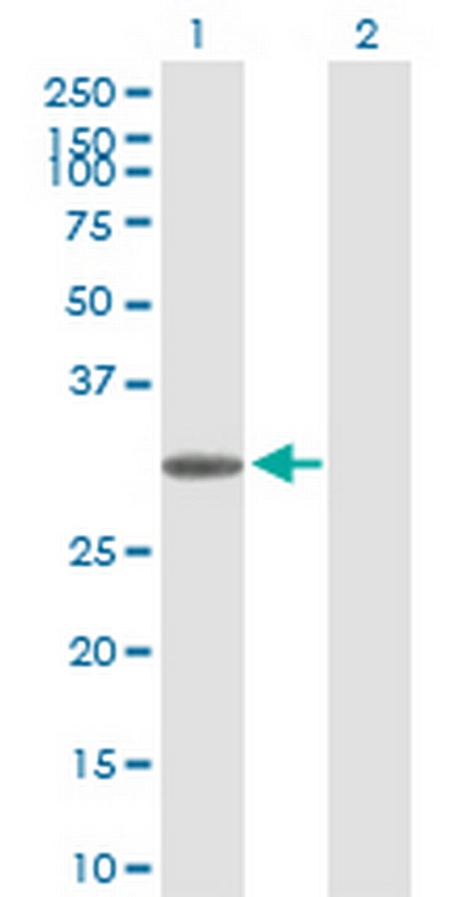 TRH Antibody in Western Blot (WB)