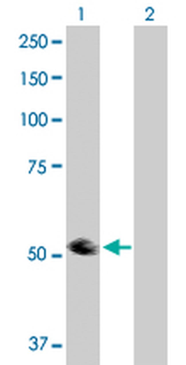 TRIP6 Antibody in Western Blot (WB)