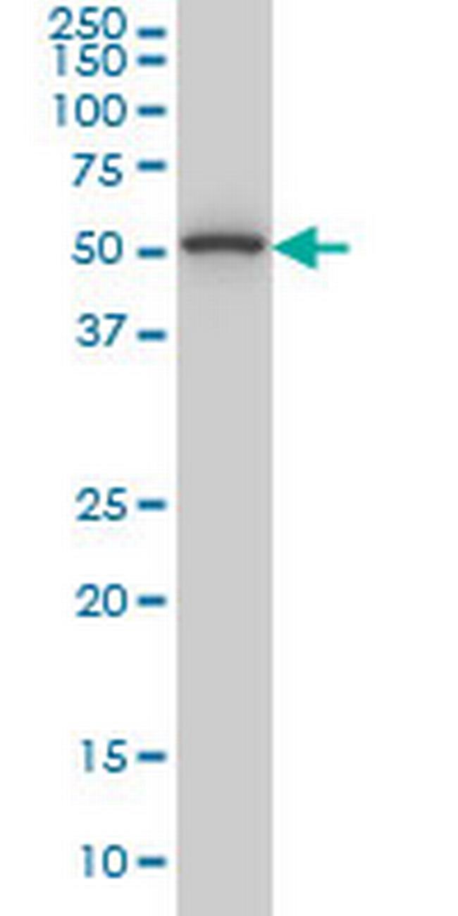 TRIP6 Antibody in Western Blot (WB)
