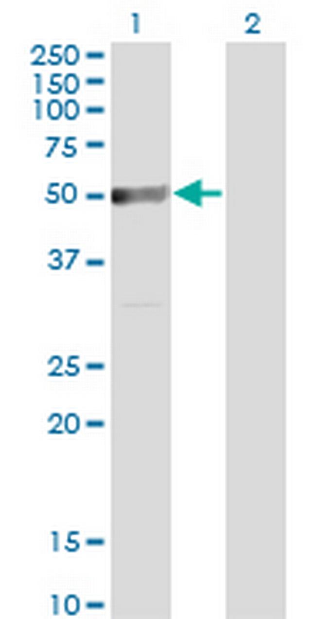 TRIP6 Antibody in Western Blot (WB)