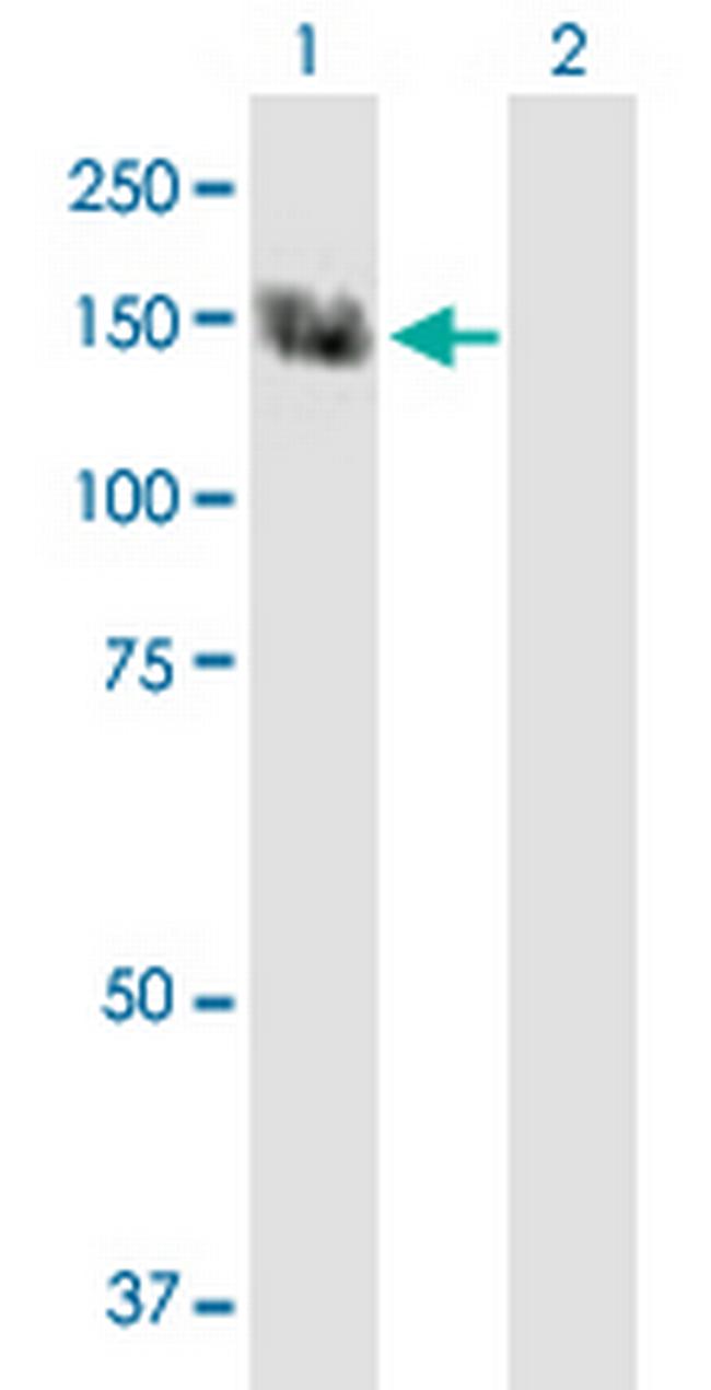 TRPC5 Antibody in Western Blot (WB)