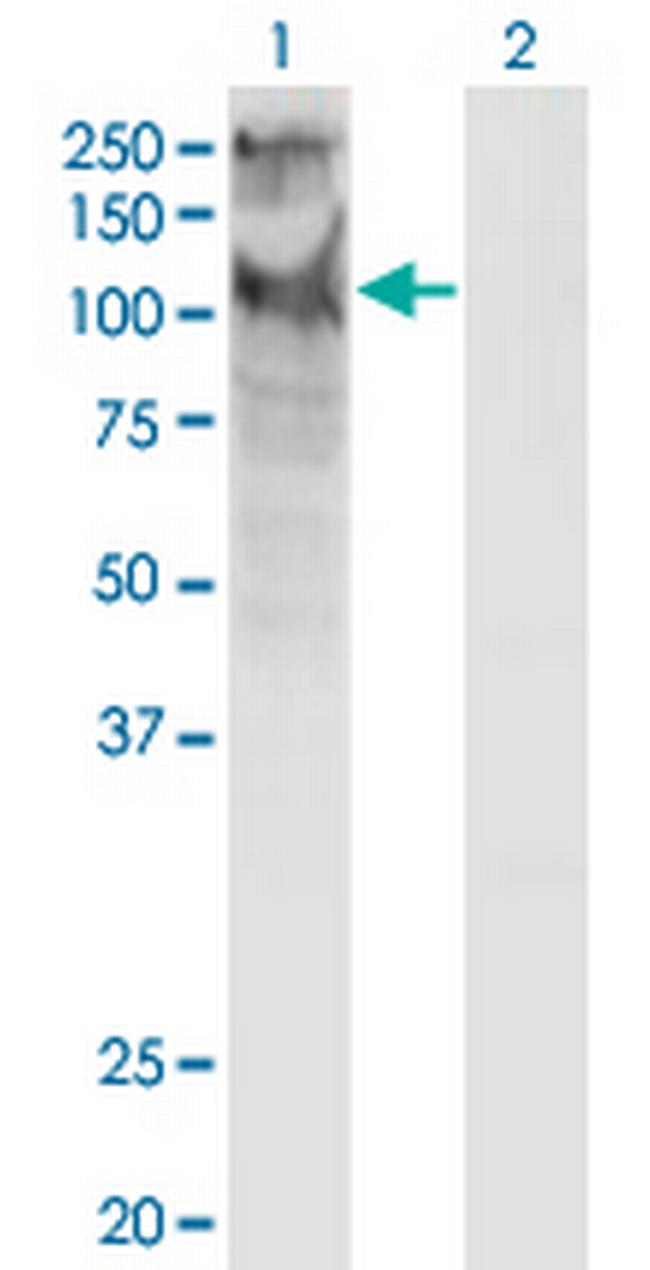 TRPC5 Antibody in Western Blot (WB)