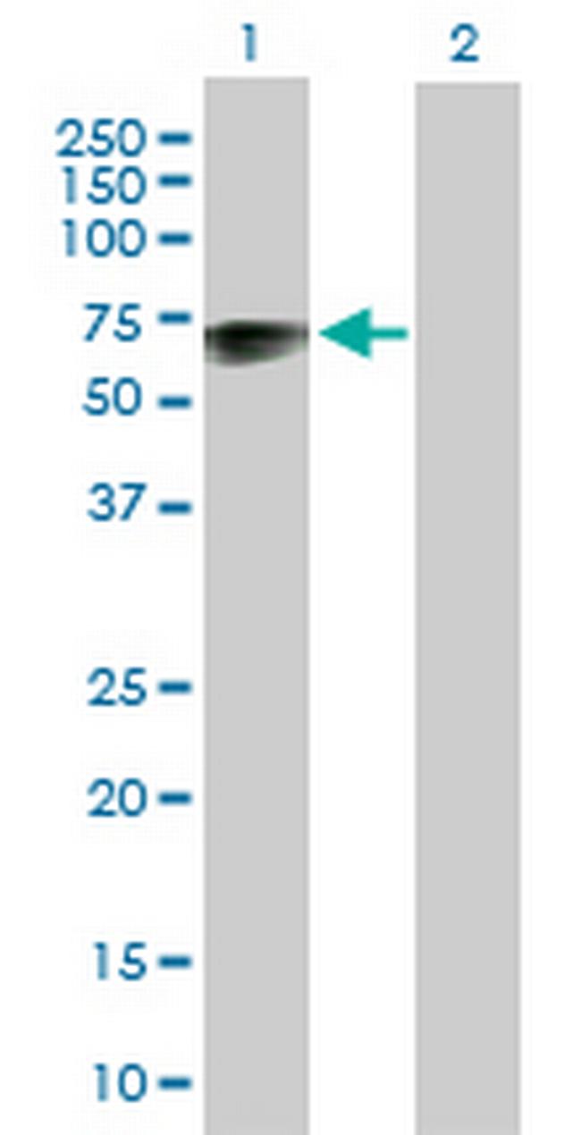 TSPYL1 Antibody in Western Blot (WB)