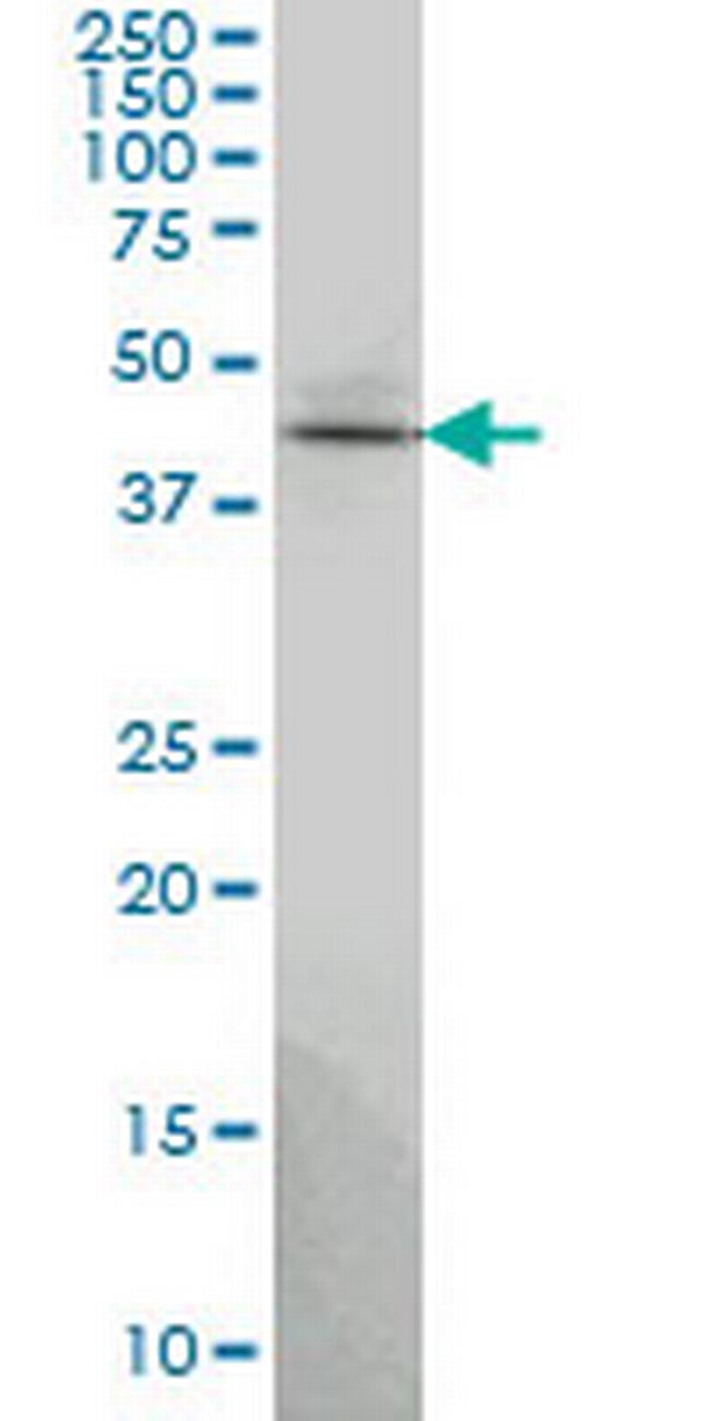 TSSC1 Antibody in Western Blot (WB)