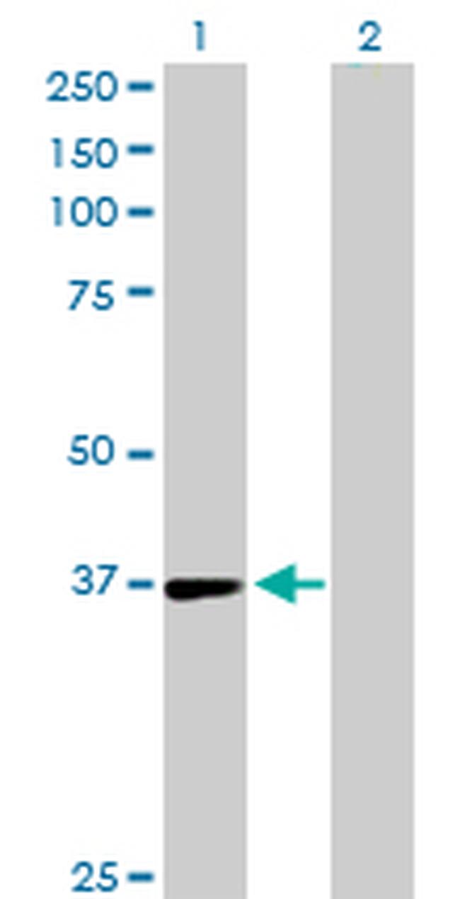 TSTA3 Antibody in Western Blot (WB)