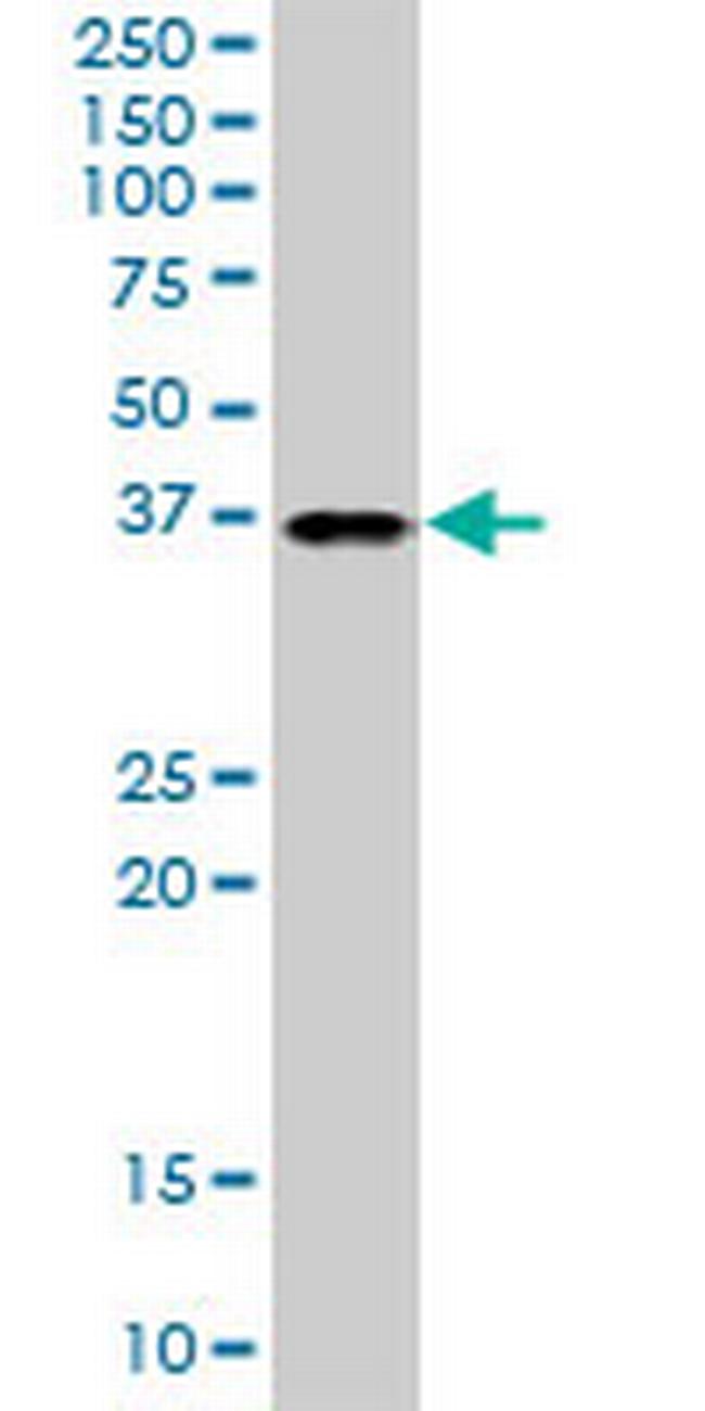 TTC1 Antibody in Western Blot (WB)