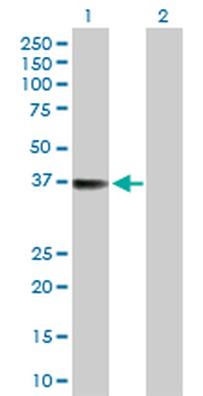 TTC1 Antibody in Western Blot (WB)