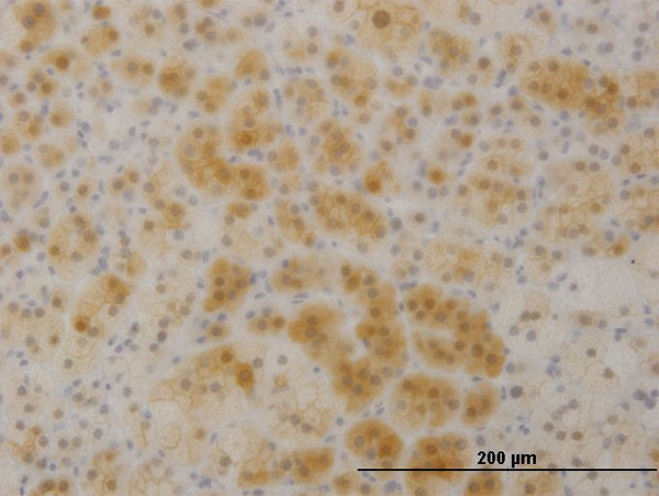 TTC1 Antibody in Immunohistochemistry (Paraffin) (IHC (P))