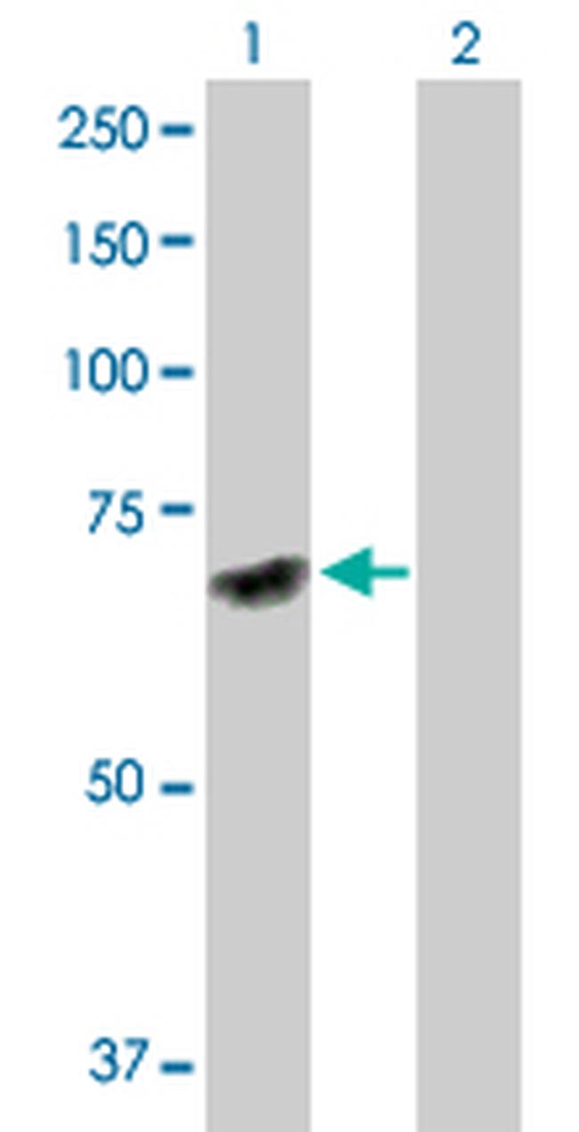 DNAJC7 Antibody in Western Blot (WB)