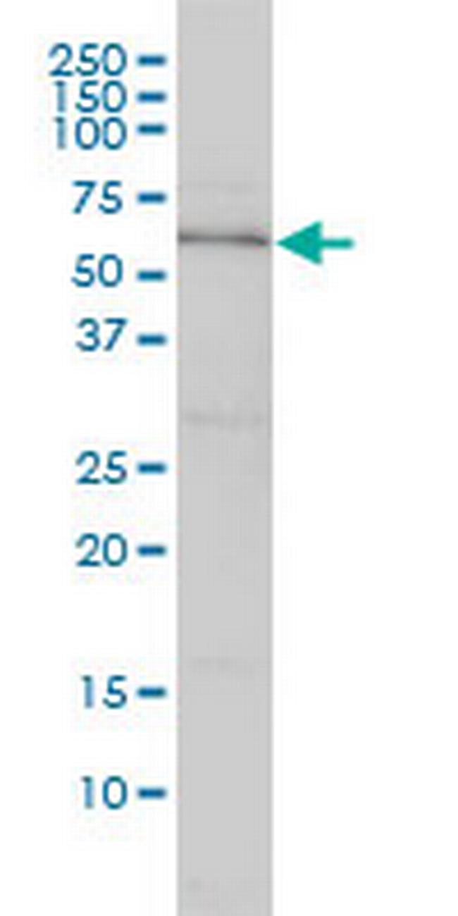 DNAJC7 Antibody in Western Blot (WB)