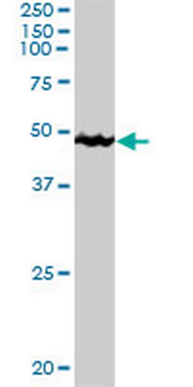 TTC4 Antibody in Western Blot (WB)