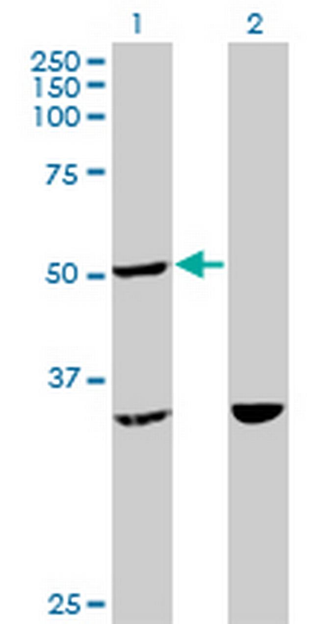 TTC4 Antibody in Western Blot (WB)