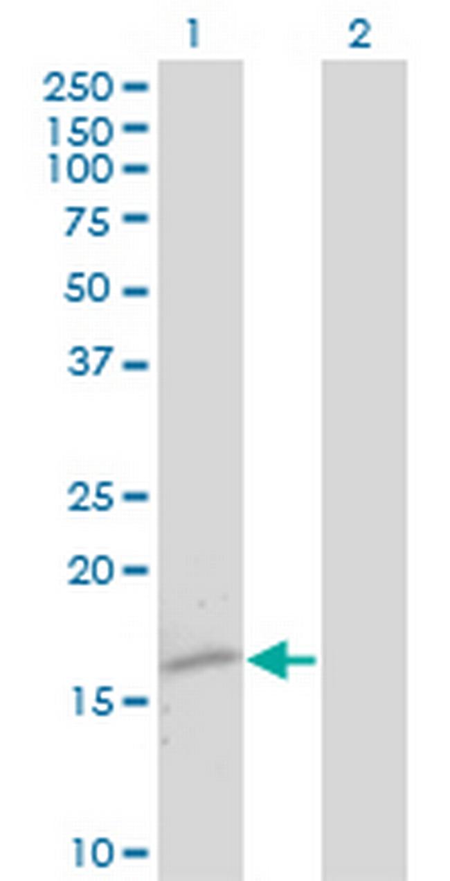 TTR Antibody in Western Blot (WB)