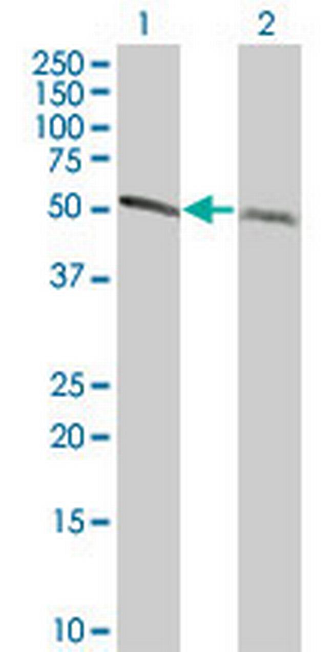 TUBA1 Antibody in Western Blot (WB)