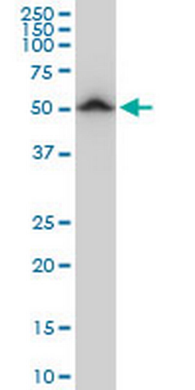 TUBB2A Antibody in Western Blot (WB)