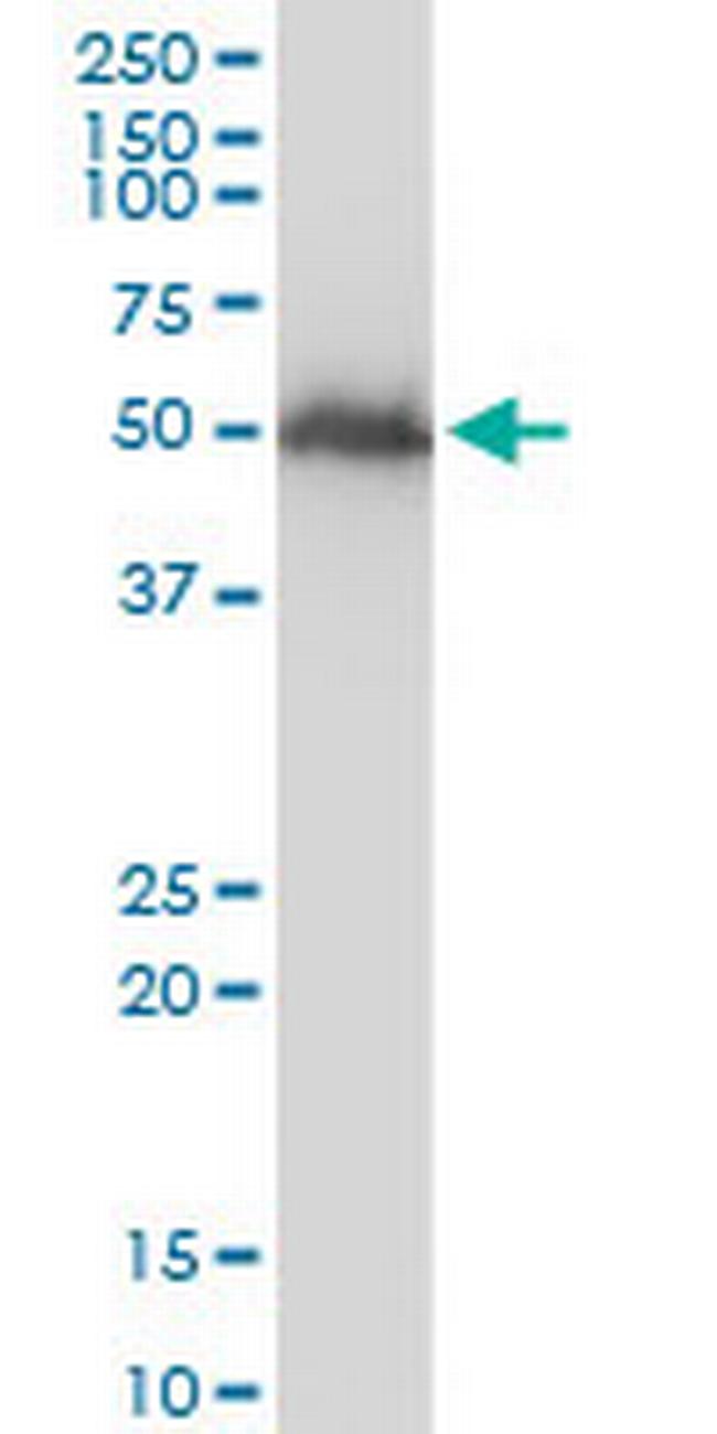 TUBB2A Antibody in Western Blot (WB)