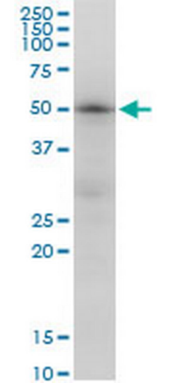 TUBB2A Antibody in Western Blot (WB)