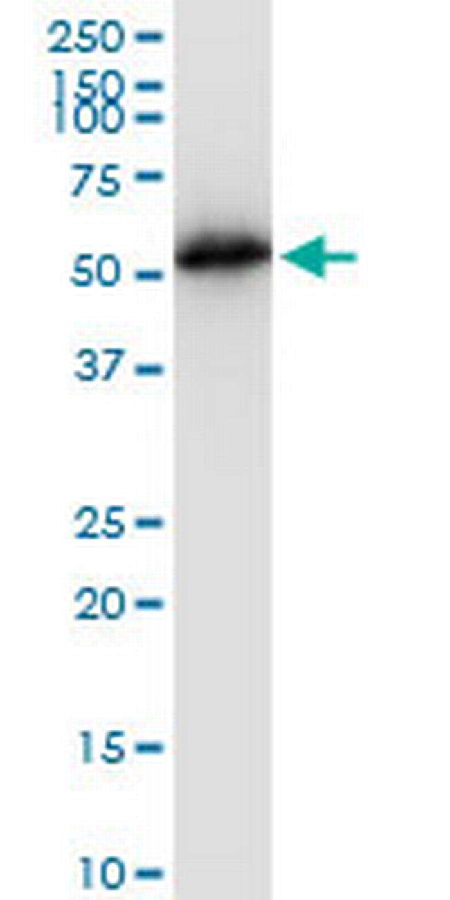 TUBB2A Antibody in Western Blot (WB)