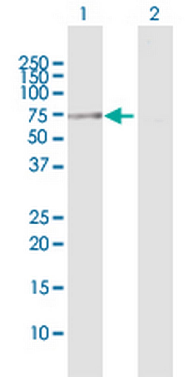 TUBG1 Antibody in Western Blot (WB)
